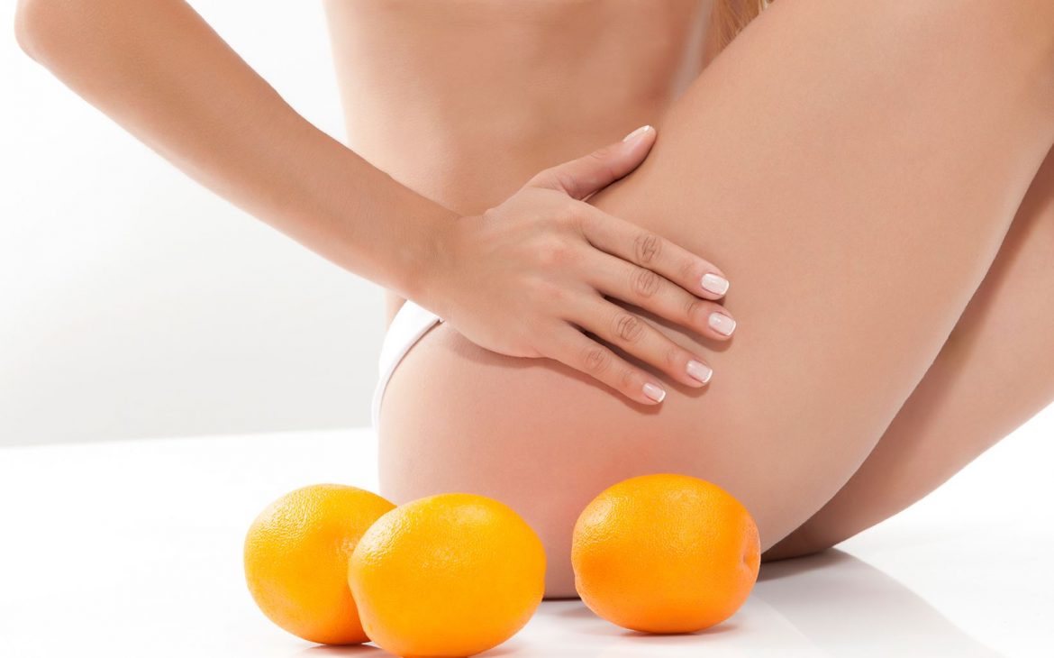 5 βήματα για να..διώξεις την κυτταρίτιδα! | #Hx2com